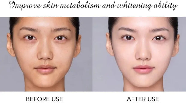 AILKE 24K Collagen Facial Whitening Set, Reduce Black Spots, Freckles, Brightening, Moisturizing Beauty Set For All Skin Types