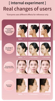 Facial Lifting Device LED Photon Therapy Facial Slimming Vibration Massager Double Chin V Face Shaped Cheek Lift  Belt Machine