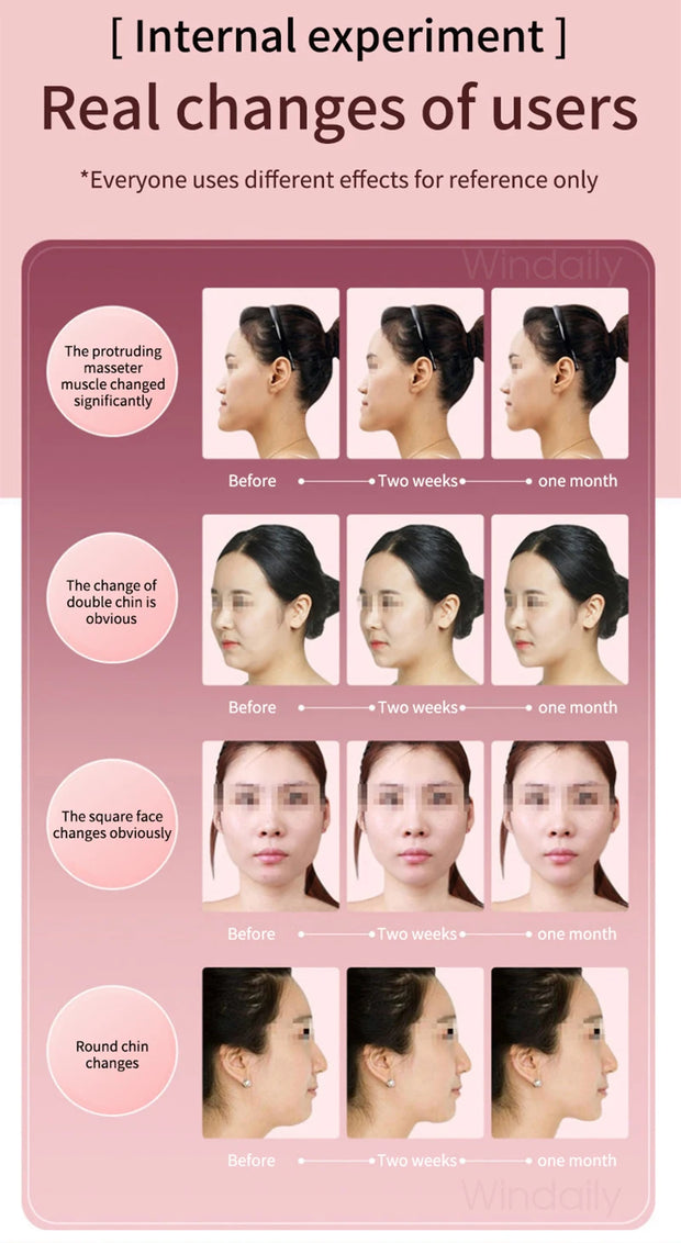 Facial Lifting Device LED Photon Therapy Facial Slimming Vibration Massager Double Chin V Face Shaped Cheek Lift  Belt Machine