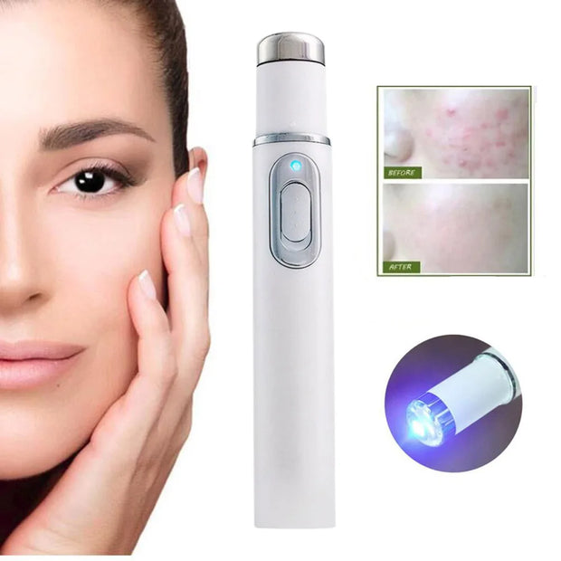 Blue Light Therapy Acne Pen LED Face Light Therapy For Scar Wrinkle Removal Treatment Device Skin Care Beauty Equipment