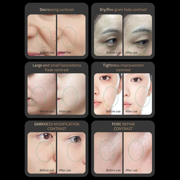 Red Light Collagen Regeneration Anti-Aging RF Anti-Wrinkle Beauty Device EMS Microcurrent Skin Tightening Face Lifting Massager