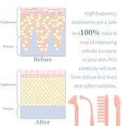 High Frequency Facial Machine 4 In 1 Handheld Electric For Face Skin Beauty Tools Portable Neon Wand Acne Treatment Therapy Wand