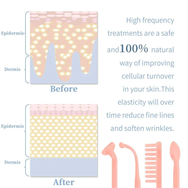 High Frequency Facial Machine 4 In 1 Handheld Electric For Face Skin Beauty Tools Portable Neon Wand Acne Treatment Therapy Wand