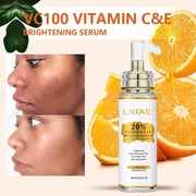 AILKE Vitamin C Skin Care Set, with Lightening Body Lotion, Even Skin Tone Face Cream, Whitening Serum, Brightening Soap