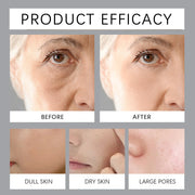 Tripeptide Lipid Facial Cream Ceramide Anti-Aging Tighten Sagging Skin Deeply Moisturize Efficient Nourishmen Coconut Acid 50g