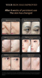 Red Light Collagen Regeneration Anti-Aging RF Anti-Wrinkle Beauty Device EMS Microcurrent Skin Tightening Face Lifting Massager