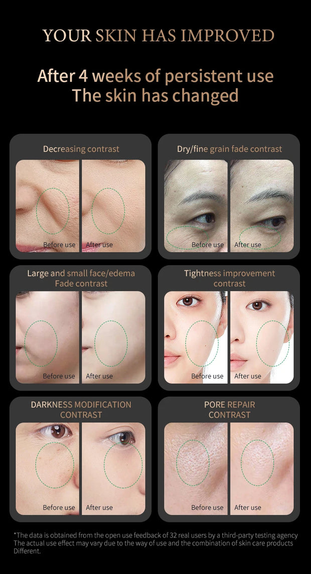 Red Light Collagen Regeneration Anti-Aging RF Anti-Wrinkle Beauty Device EMS Microcurrent Skin Tightening Face Lifting Massager