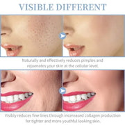 High Frequency Facial Machine 4 In 1 Handheld Electric For Face Skin Beauty Tools Portable Neon Wand Acne Treatment Therapy Wand